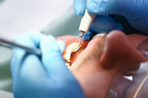 Best Emergency Tooth Extraction  in Centralia, IL