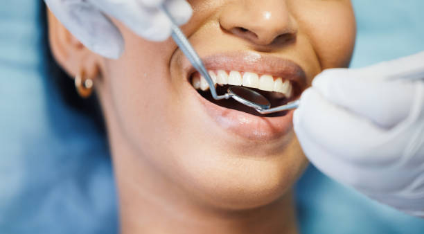 Best Teeth Whitening  in Centralia, IL